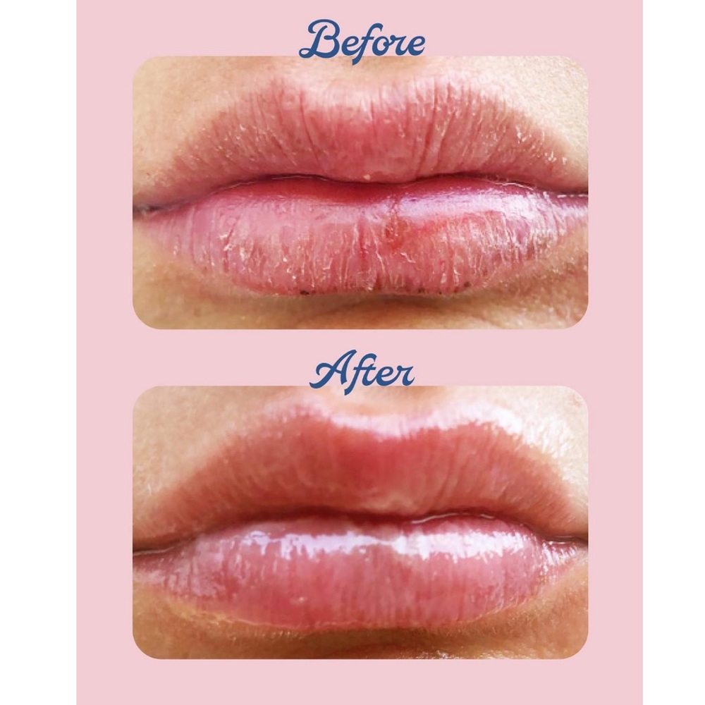 Lanolips Coconutter Multi-Balm Mini Duo - Picture 2 of 3